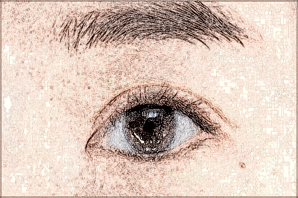 2024中山市人民醫(yī)院飛秒手術價格一覽表?飛秒手術后注意事項