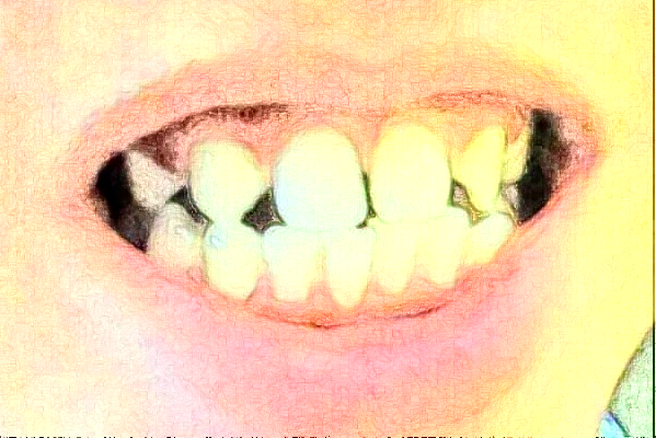 2024常州市第三人民醫(yī)院口腔科鑲牙價目表(價格表)怎么樣