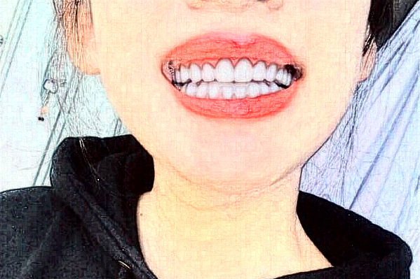 南京鼓樓醫(yī)院種植牙好的大夫都有誰(shuí)?醫(yī)生簡(jiǎn)介