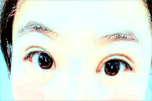 杭州市第一人民醫(yī)院近視激光手術(shù)做的怎么樣？醫(yī)生推薦