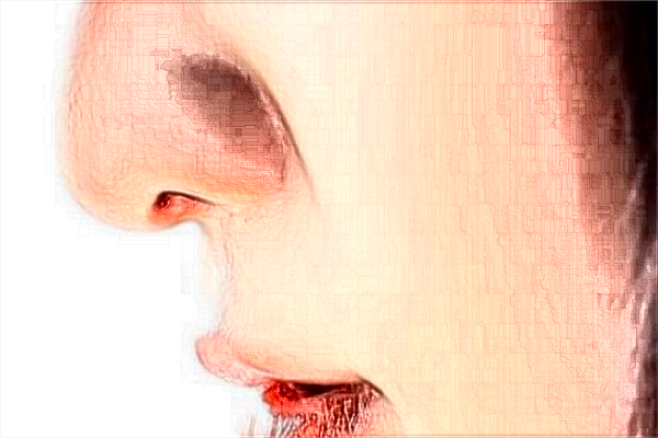 南京鼓樓醫(yī)院熱拉提做的好嗎？誰(shuí)做的好