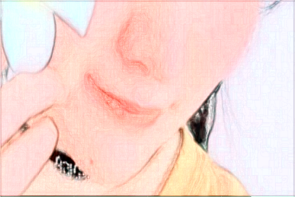 金華市中醫(yī)院光子嫩膚多少費用？醫(yī)生排名