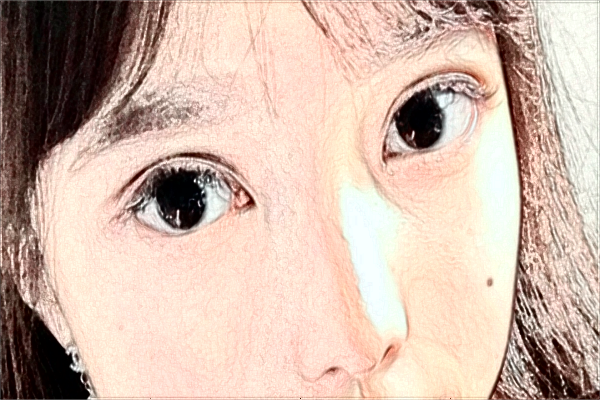 大連大學(xué)附屬中山醫(yī)院近視手術(shù)誰做的好_做的怎么樣