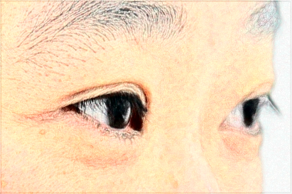 2024合肥市第一人民醫(yī)院割雙眼皮做的好嗎_哪位醫(yī)生做的好