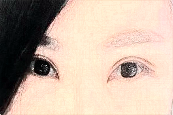 2024合肥市第一人民醫(yī)院割雙眼皮做的好嗎_哪位醫(yī)生做的好