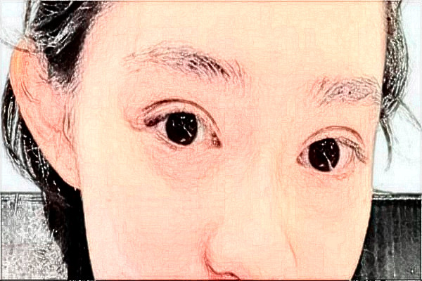 2024無(wú)錫市第一人民醫(yī)院全飛秒誰(shuí)做的好?醫(yī)生推薦