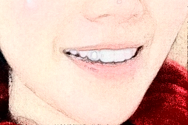 2024南京中大醫(yī)院口腔科烤瓷冠做的怎么樣_誰做的比較好