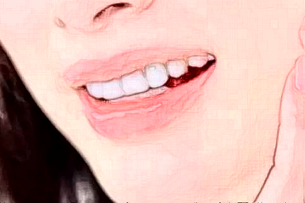 2024南京中大醫(yī)院口腔科前牙種植怎么樣_醫(yī)生名單推薦