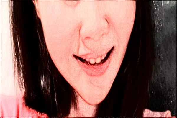 2024溫州醫(yī)學(xué)院附屬第二醫(yī)院口腔科面部不對(duì)稱矯正誰做的好