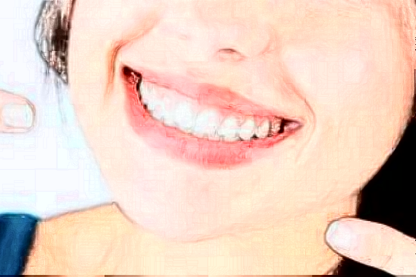 2024天津醫(yī)科大學(xué)第二醫(yī)院口腔科全瓷牙怎么樣_誰做得好