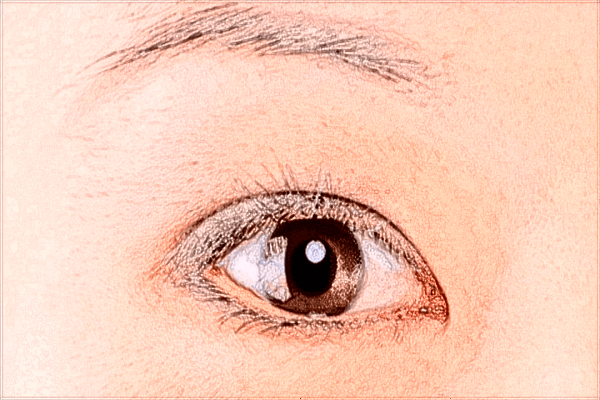 中山大學(xué)附屬第一醫(yī)院激光近視怎么樣?2024激光近視價格