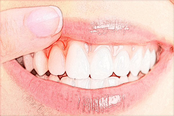 2024青島市立醫(yī)院種植牙齒多少錢?種植牙齒哪種材質比較好