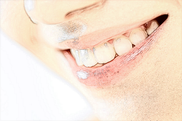 青島市立醫(yī)院洗牙怎么樣?洗牙能把牙洗白嗎