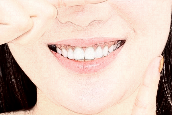 中山大學(xué)附屬口腔醫(yī)院正畸醫(yī)生好嗎?2024收費(fèi)價格