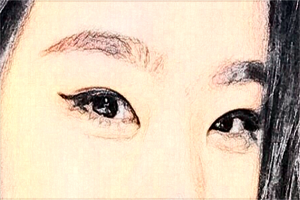 2024哈爾濱醫(yī)科大學附屬第一醫(yī)院做雙眼皮做的好嗎_雙眼皮整形日記分享