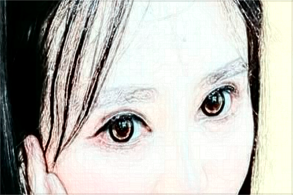 2024江蘇大學(xué)附屬醫(yī)院祛痣做的好嗎_體驗(yàn)分享