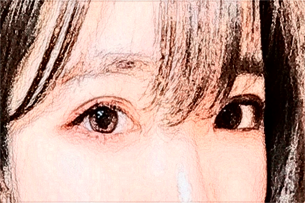 阜陽市人民醫(yī)院割雙眼皮做的好嗎？誰做的好？