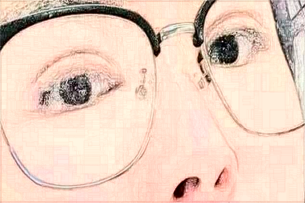 蘇州大學(xué)附屬兒童醫(yī)院近視手術(shù)怎么樣_哪位醫(yī)生做的好