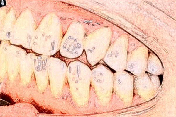 貴陽醫(yī)學(xué)院附屬醫(yī)院牙科專家哪個(gè)好?牙齒矯正比較好的醫(yī)生