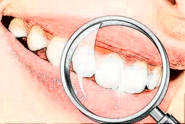 2024哈爾濱242醫(yī)院口腔科單顆牙種植貴嗎？醫(yī)生哪個做的好?