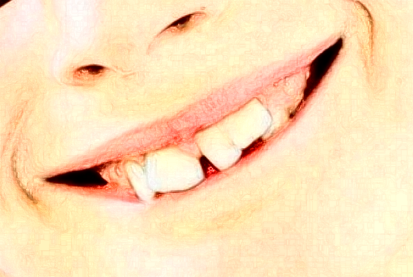 2024杭州市第一人民醫(yī)院口腔科全瓷牙怎么樣_誰(shuí)做得好