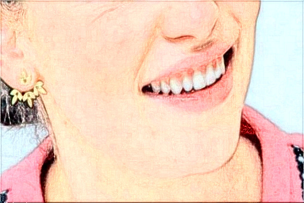 2024天津醫(yī)科大學(xué)總醫(yī)院口腔科頜面畸形矯正做的好嗎?哪位醫(yī)生比較有名氣