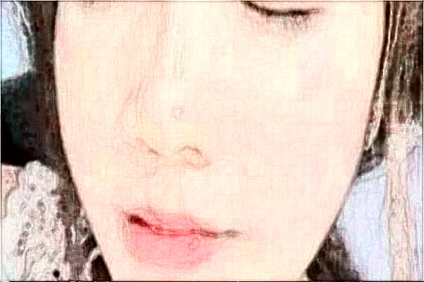 河北省人民醫(yī)院自體脂肪填充面部做的好嗎?真實案例反饋