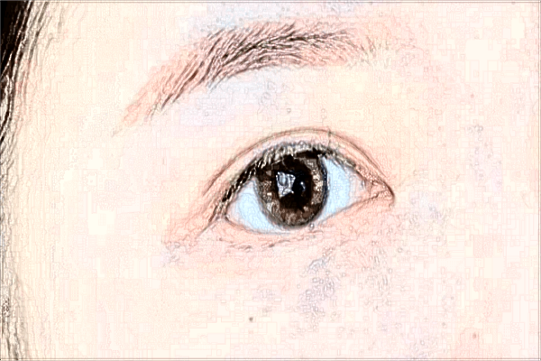 貴陽(yáng)市第—人民醫(yī)院近視眼手術(shù)好嗎?2024近視眼手術(shù)多少錢