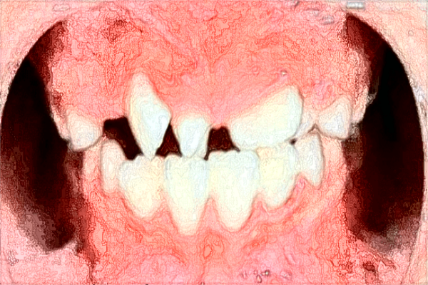 貴陽市第一人民醫(yī)院口腔科綜合怎么樣?2024收費(fèi)價(jià)格如何