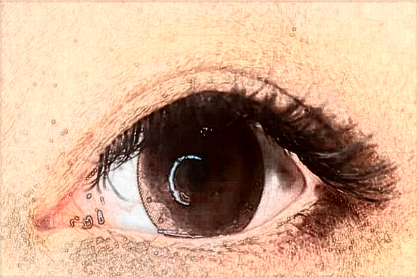 2024山西醫(yī)科大學(xué)第一醫(yī)院半飛秒怎么樣_整形日記分享