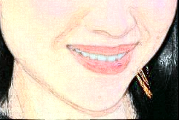 2024哈爾濱242醫(yī)院口腔科拔智齒多少錢(qián)？拔智齒日記展示