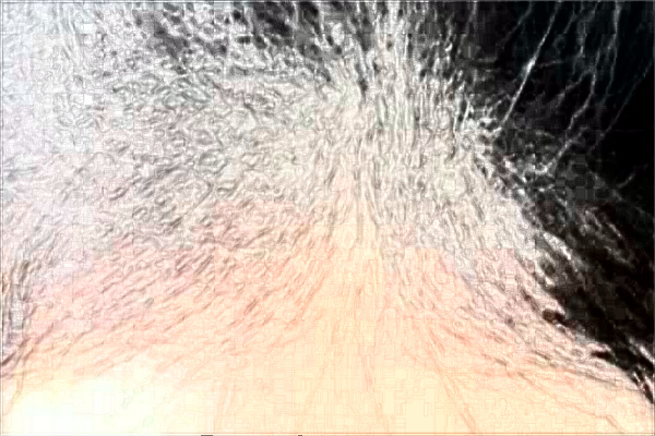 南通大學(xué)附屬醫(yī)院植發(fā)做的好嗎？誰做的好