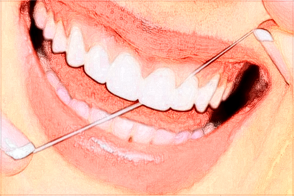 2024中山大學附屬第三醫(yī)院矯正牙齒價格?矯正牙齒凸嘴嗎