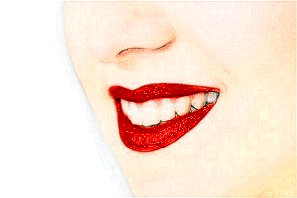 中山大學(xué)附屬第三醫(yī)院補(bǔ)牙掛什么科?2024補(bǔ)牙多少錢(qián)一顆牙