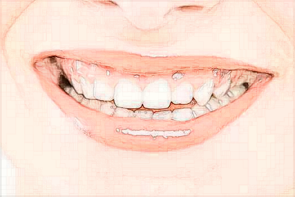 佛山市第二人民醫(yī)院口腔科哪個(gè)醫(yī)生好?口腔科怎么樣?