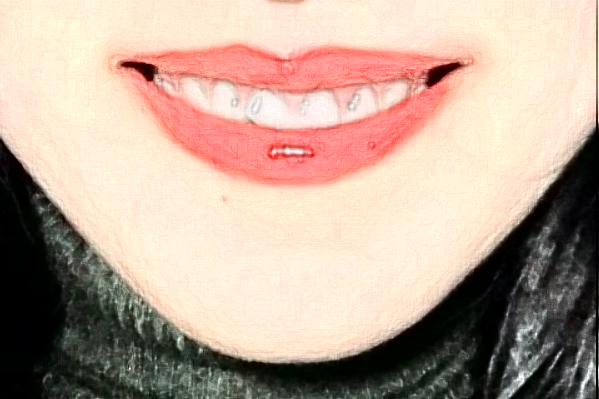 河北省人民醫(yī)院口腔科成人正畸怎么樣_誰做得好