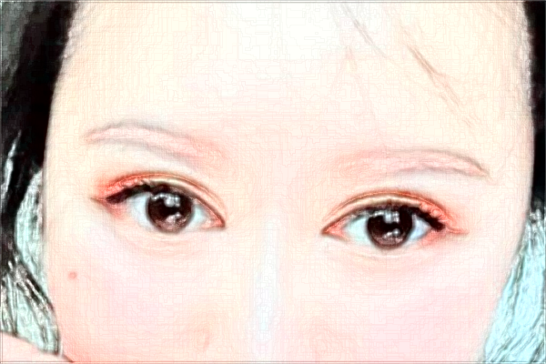 2024太原市中心醫(yī)院近視激光手術(shù)怎么樣?實測案例分享