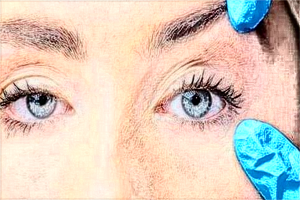 吉林大學(xué)第一醫(yī)院半飛秒做的好嗎?誰做得好