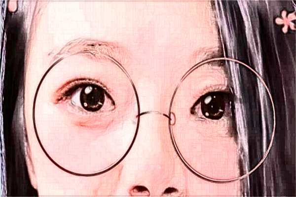 天津市第三中心醫(yī)院全飛秒做的怎么樣,哪位醫(yī)生技術(shù)比較好