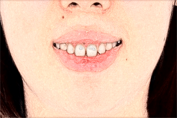 青島市婦女兒童醫(yī)院口腔科怎么樣?口腔科好嗎