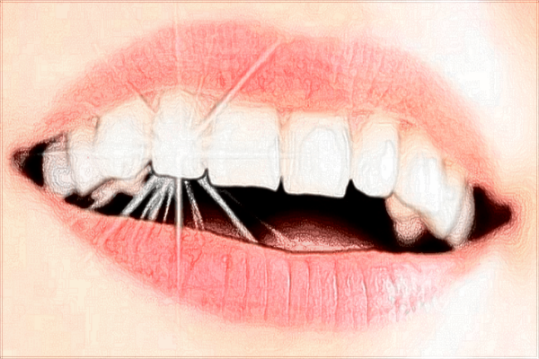 2024中山大學附屬口腔醫(yī)院植牙價格?植牙后注意事項