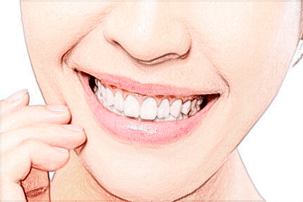 2024中山大學附屬口腔醫(yī)院鑲牙多少錢?鑲牙和種牙的區(qū)別