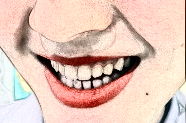 2024丹東市第一醫(yī)院種植牙修復(fù)價(jià)格多少_真實(shí)案例分享