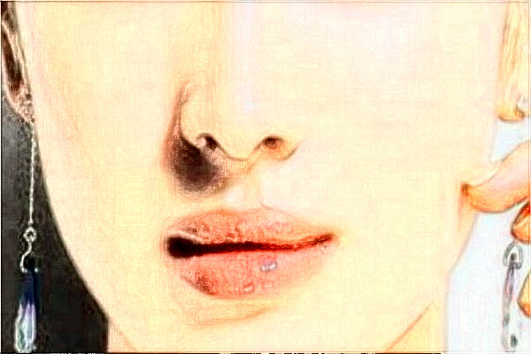 2024天津醫(yī)科大學(xué)總醫(yī)院可以去胎記嗎？去胎記真實案例