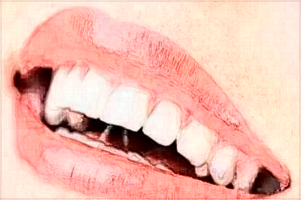 2024江蘇大學(xué)附屬醫(yī)院口腔科全口牙種植價(jià)目表(價(jià)格表)怎么樣