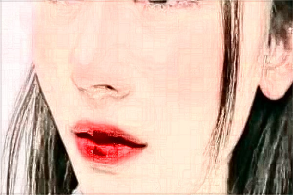 保定市第一中心醫(yī)院去疤痕做的好嗎?案例反饋