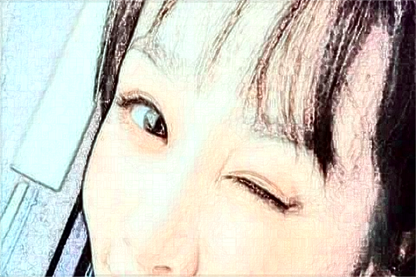 天津醫(yī)科大學(xué)總醫(yī)院光子嫩膚價(jià)格多少?光子嫩膚案例分享