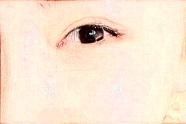 大連新華醫(yī)院近視手術(shù)誰做的好?醫(yī)生推薦