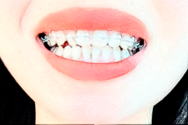 蘇州大學附屬兒童醫(yī)院口腔科超聲波潔牙誰做的好?