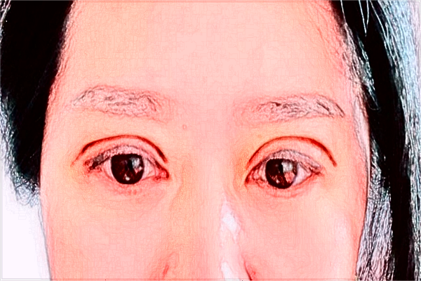 綿陽(yáng)市中心醫(yī)院割雙眼皮價(jià)位多少_醫(yī)生介紹